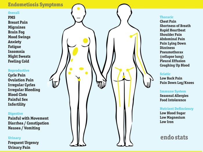 endostatsgraphics-round-symptoms-06_3_orig